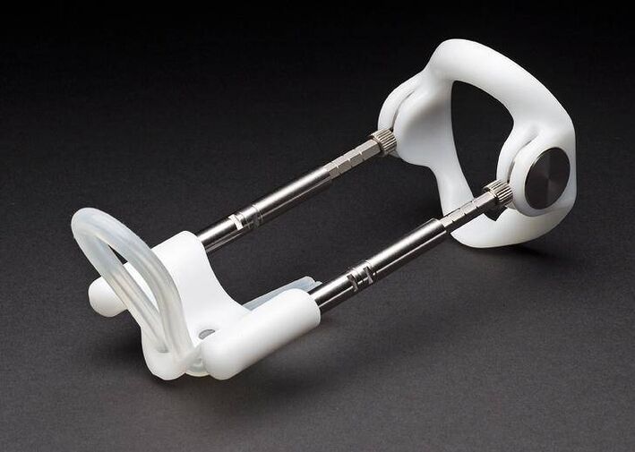 Extenseur après une opération d'agrandissement du pénis